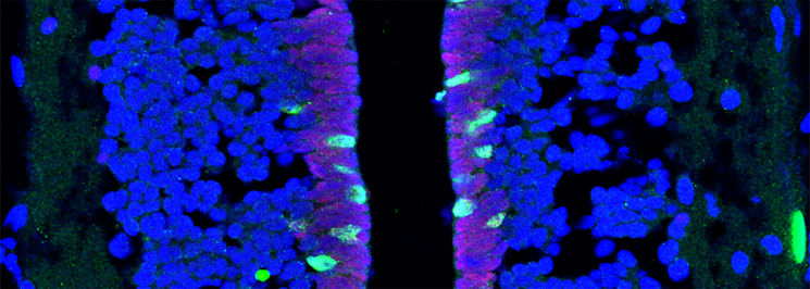 Spinal cord transection activates Sox2 (red) cells to proliferate (green, BrdU incorporation)
