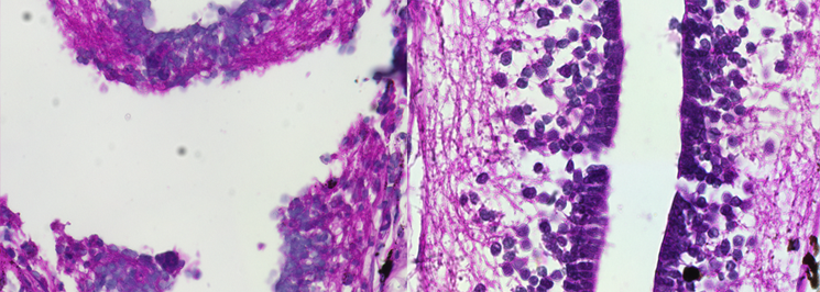 An H&E staining of a spinal cord at 2 and 30 days post-transection